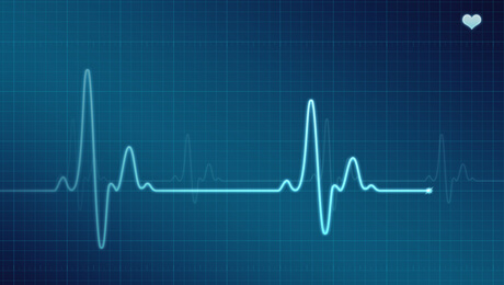 picture of an electrocardiogram signal